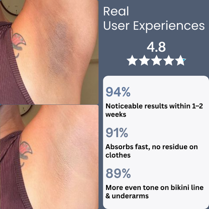 K-Beauty Ingrown Hair & Dark Spot Treatment Roller